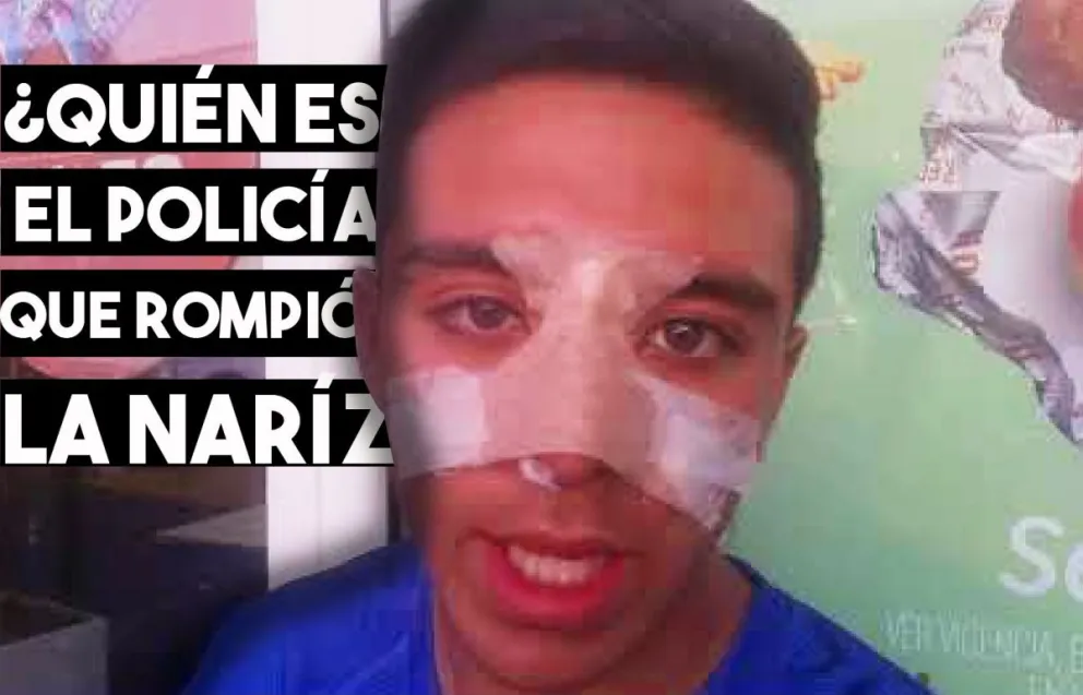 Lo boxeó un policía y le rompió la nariz