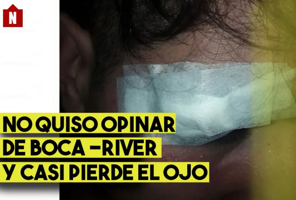 No quiso opinar del Boca - River y casi pierde el ojo por una golpiza