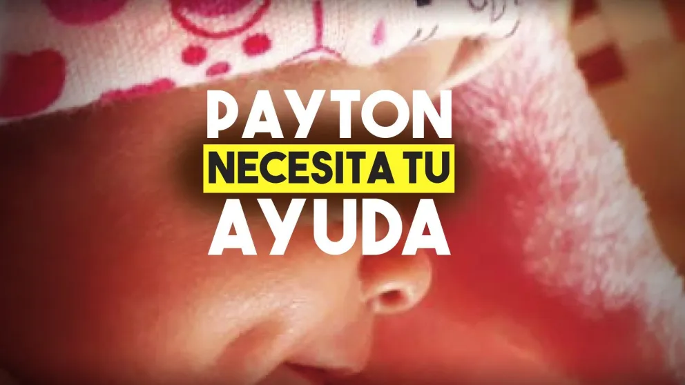 Payton necesita tu ayuda: tiene dos meses de vida y la operarán del corazón