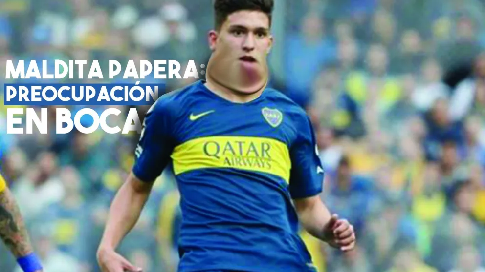 Preocupación en Boca por un caso de paperas