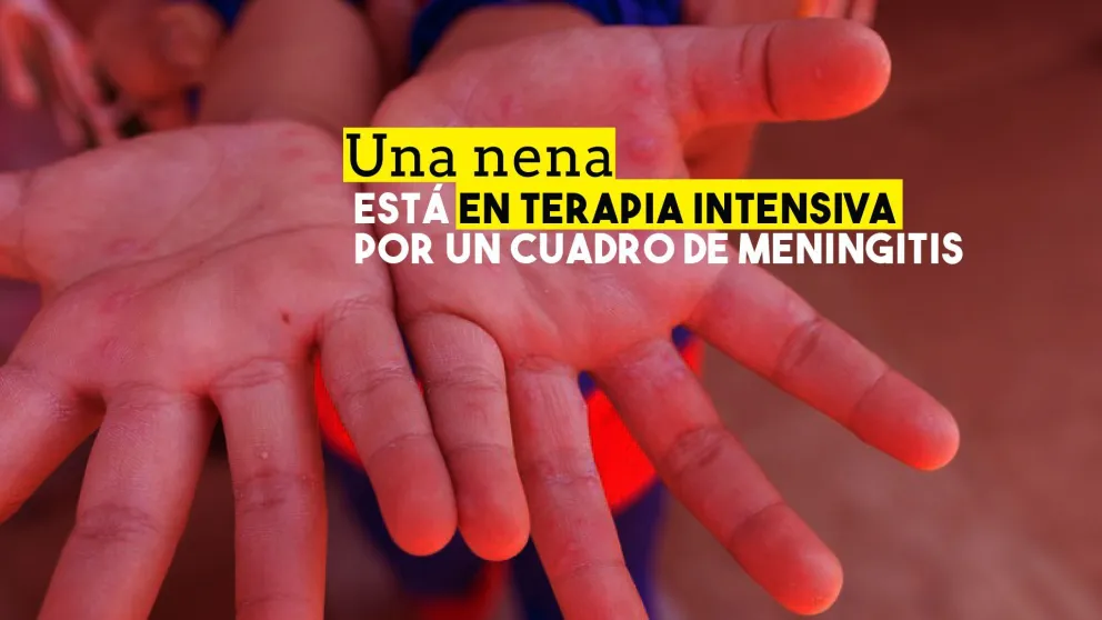 Una nena está en Terapia Intensiva por un cuadro de meningitis