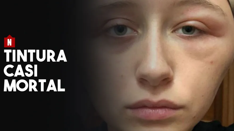 Se tiñó el pelo y le quedó la cara deformada