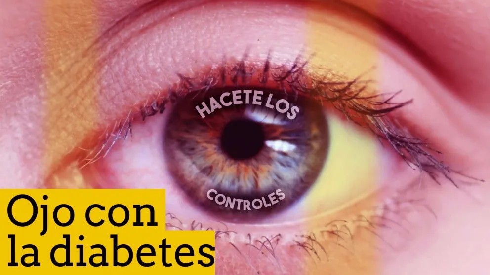Campaña Nacional de Prevención de la ceguera por Diabetes
