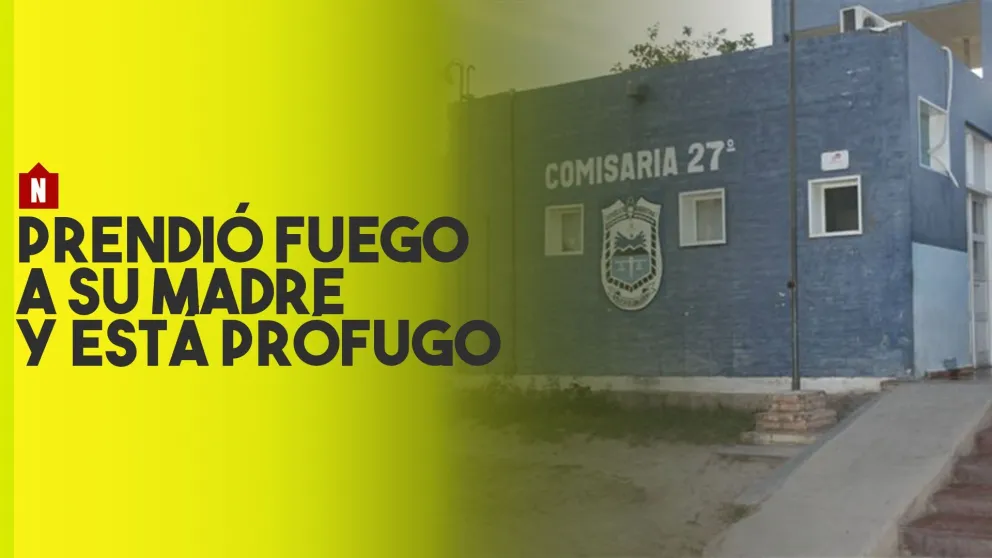 Una mujer fue atacada con fuego por su hijo