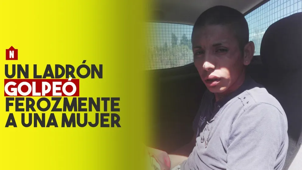 Una mujer fue ferozmente atacada por un ladrón