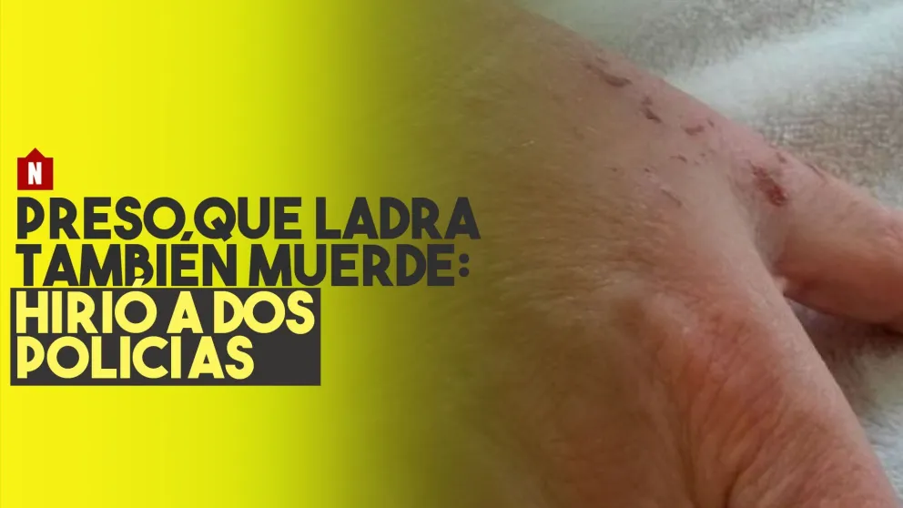 Preso que ladra también muerde: hirió a dos policías