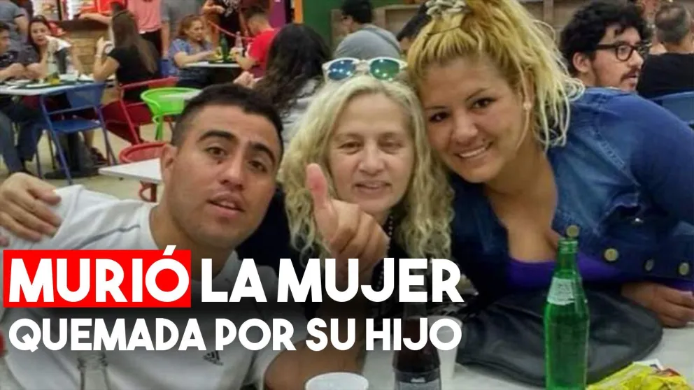 La mujer quemada por su hijo, finalmente murió