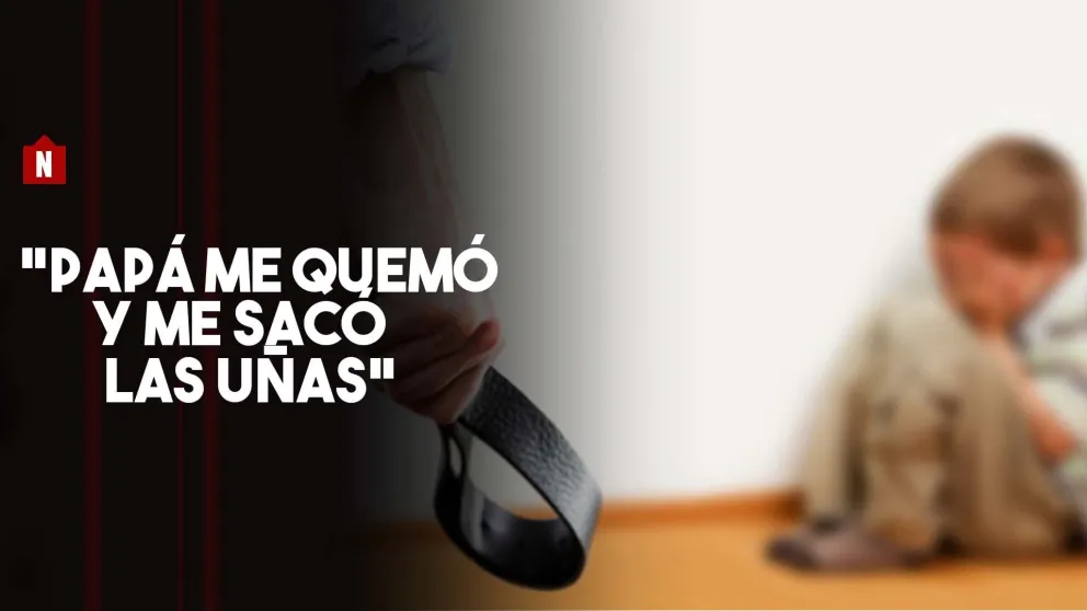 Un nene de 2 años fue atacado brutalmente por su padre