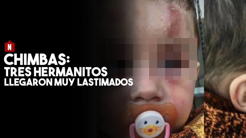 Chimbas: los nenes estaban muy lastimados