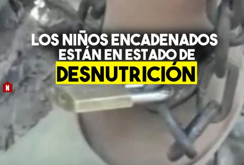 Los niños encadenados están en estado de desnutrición