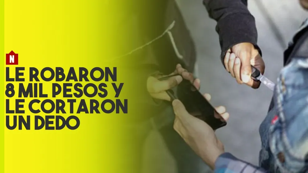 Le robaron 8 mil pesos y le cortaron un dedo