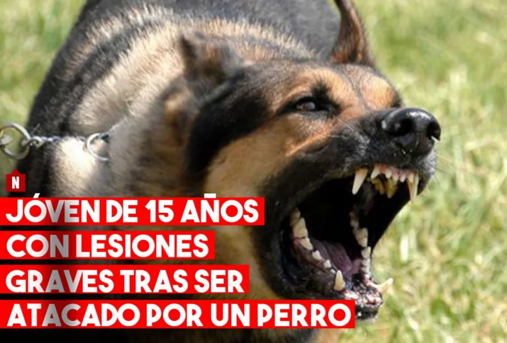 Jóven de 15 años fue atacado por un perro en su casa en Pocito