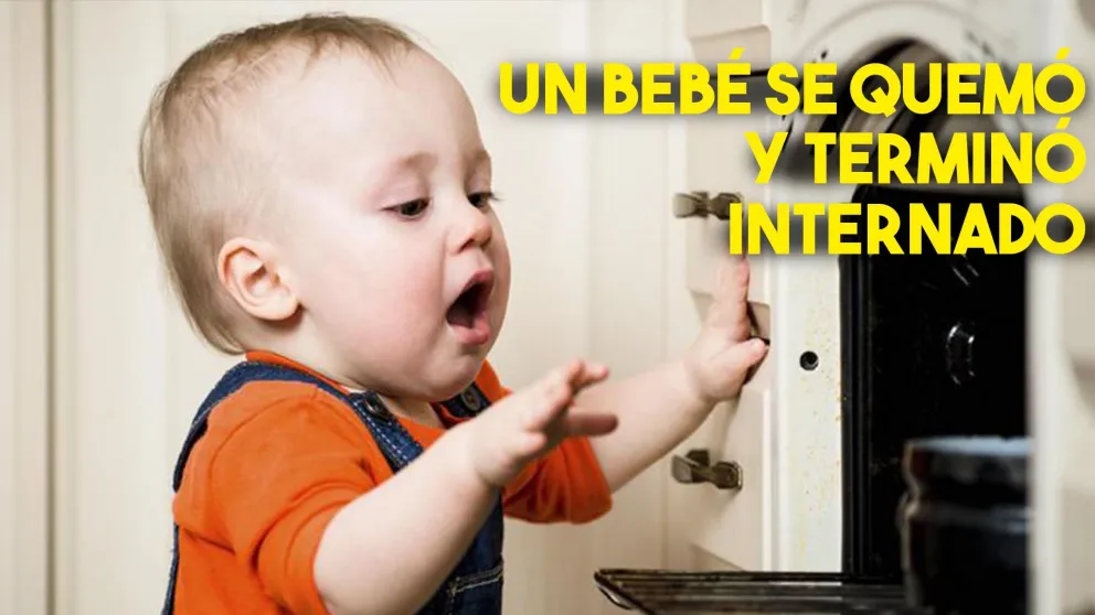 Un bebé terminó internado por haberse quemado con agua hirviendo