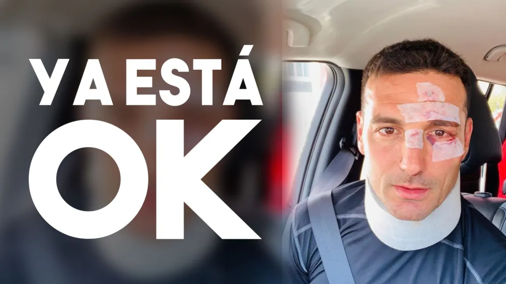 Scaloni recibió el alta tras ser atropellado