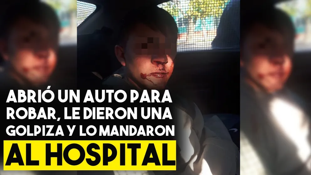 Justicia por mano propia: le dio una golpiza al ladrón que le robó