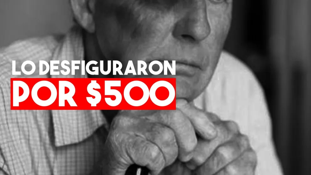 Le desfiguraron el rostro a una abuelo para robarle $500