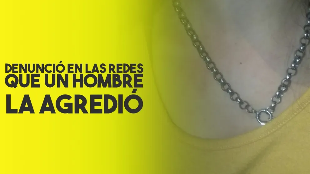 Denunció en las redes que un hombre la golpeó en plena calle