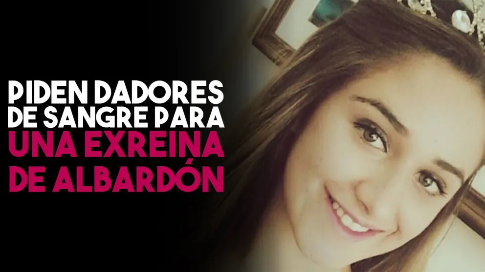 Piden dadores de sangre para una exreina departamental de Albardón