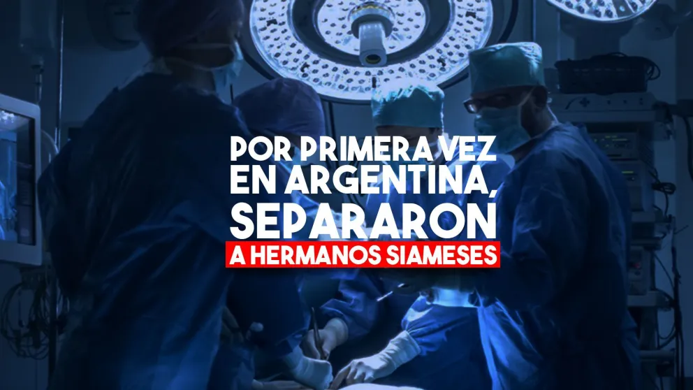 Médicos argentinos lograron separar con éxito a siameses unidos por la pelvis