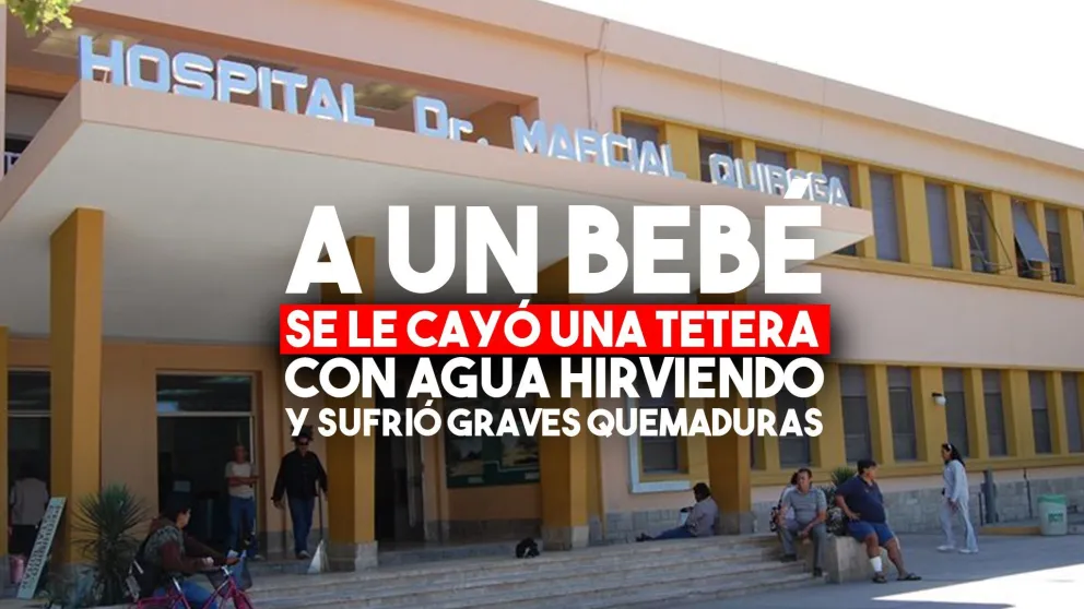 Un bebé debio ser internado tras sufrir graves quemaduras por agua hirviendo