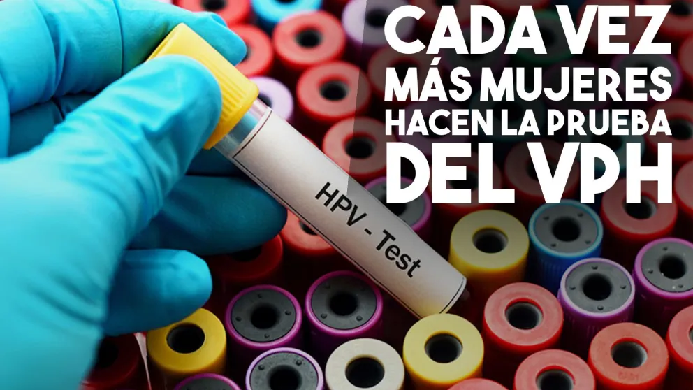 Cerca de 500 personas por mes se hacen los estudios de VPH en San Juan