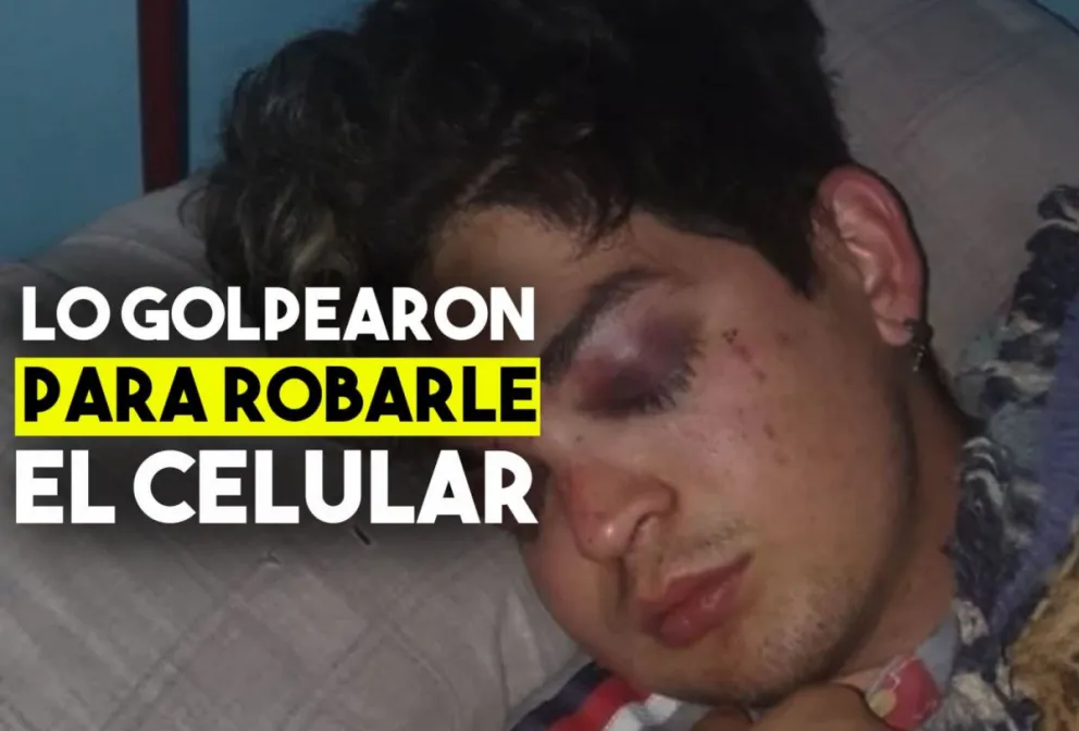 Lo golpearon salvajemente para robarle el celular