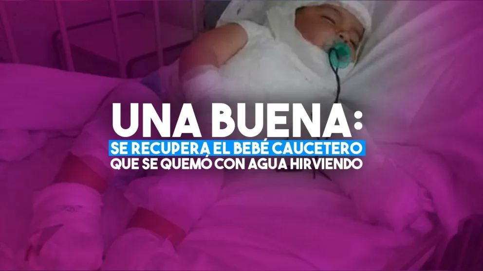 Se recupera el bebé caucetero que se quemó con agua hirviendo
