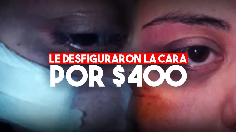 Una mujer fue víctima de una dura golpiza en un robo