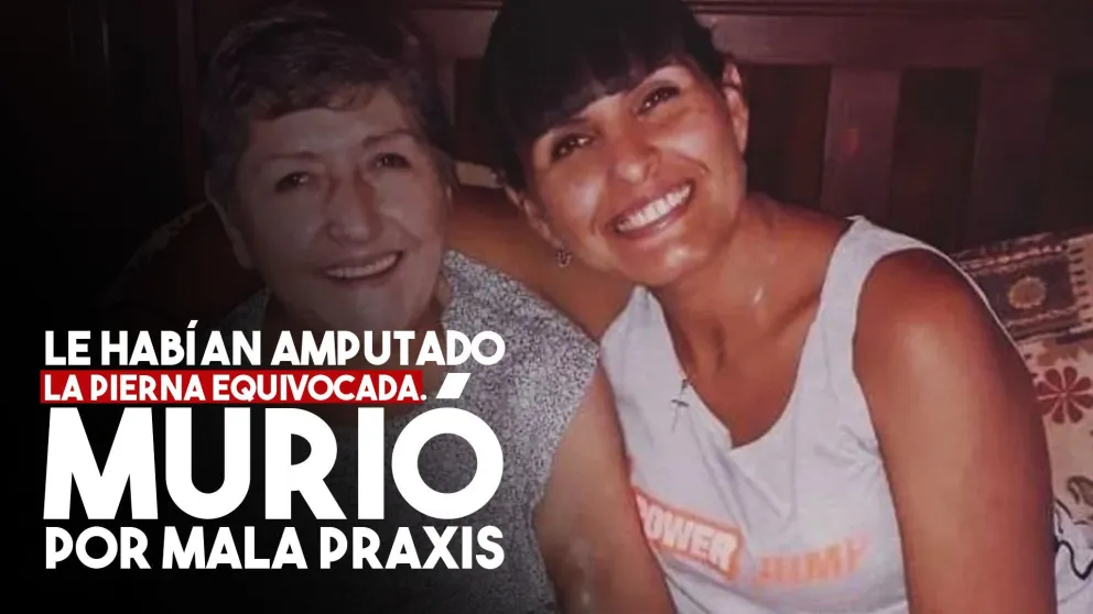 Murió la mujer a la que le habían amputado la pierna equivocada