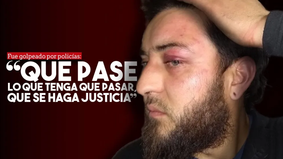 Joven golpeado por policías: "Que pase lo que tenga que pasar, que se haga justicia"