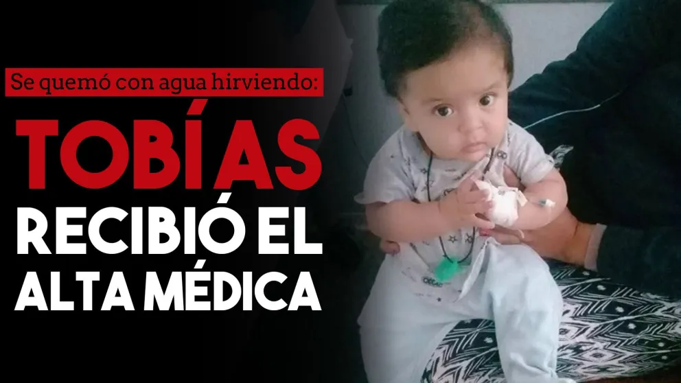 Se quemó con agua hirviendo y luego de tres semanas recibió el alta