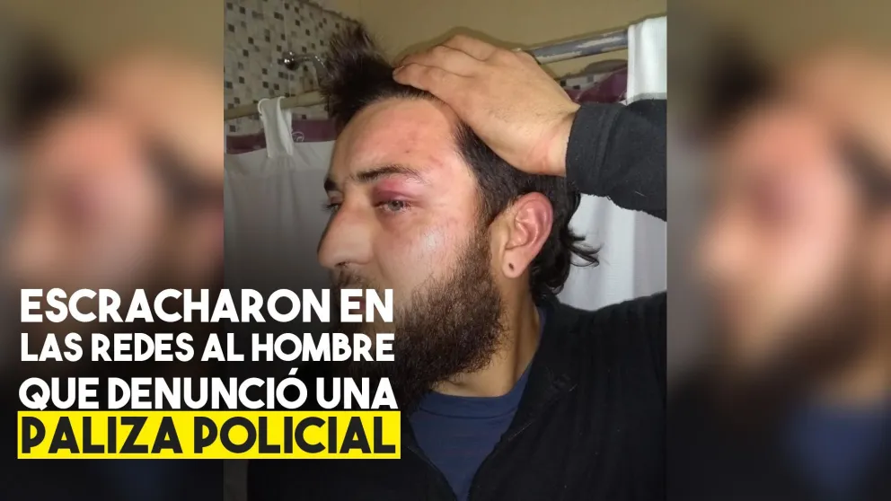 Escracharon a las redes al hombre que fue golpeado por policías