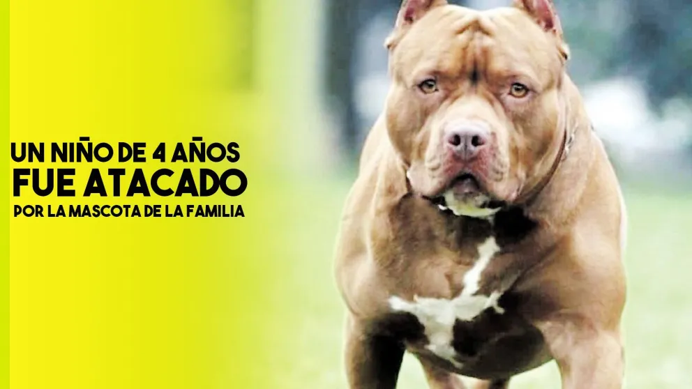 Un niño de 4 años jugaba con su pitbull, lo desconoció y lo mordió en la cara