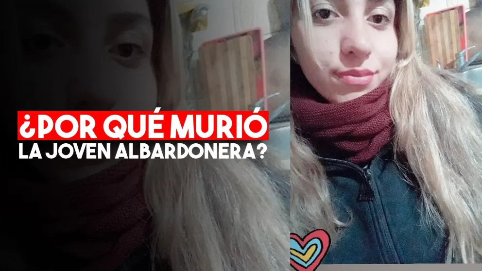Los médicos confirmaron que Nicole Ponce falleció por una reacción alérgica