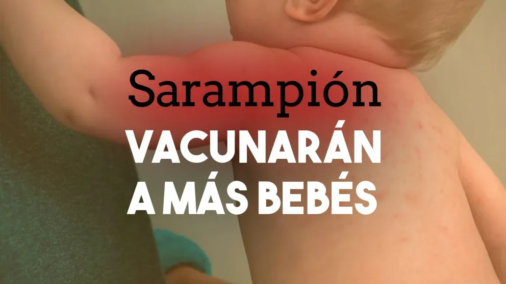 Preocupación por nuevos casos de sarampión: vacunarán a bebés de entre 6 y 11 meses