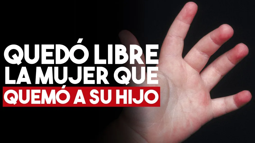 La mujer que le quemó las manos a su hijo para castigarlo quedó en libertad