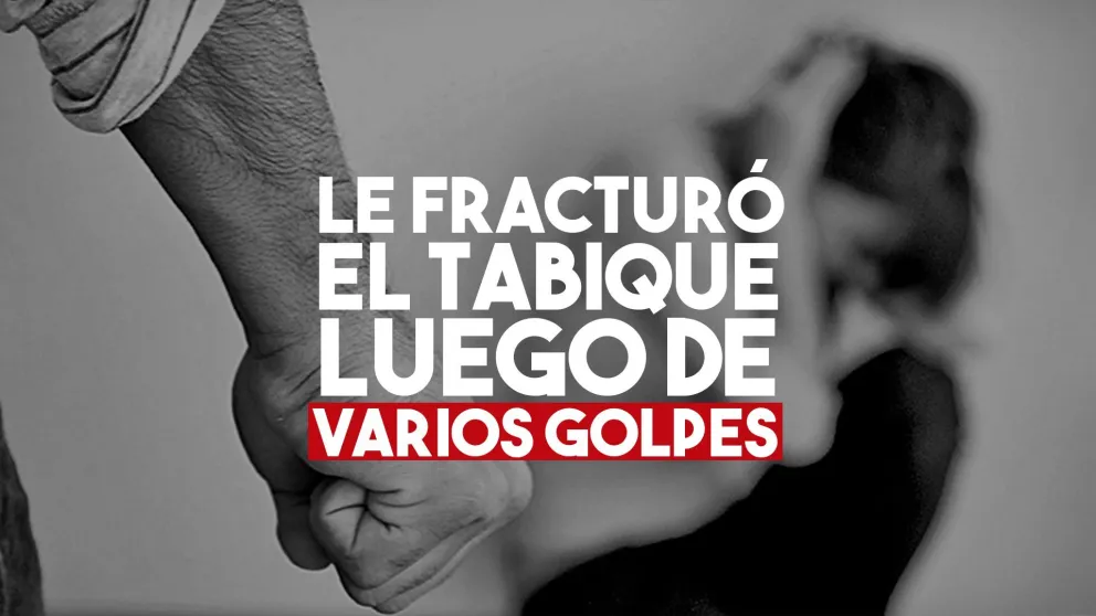 Otra vez la violencia de género: su ex le pegó y le fracturó la nariz