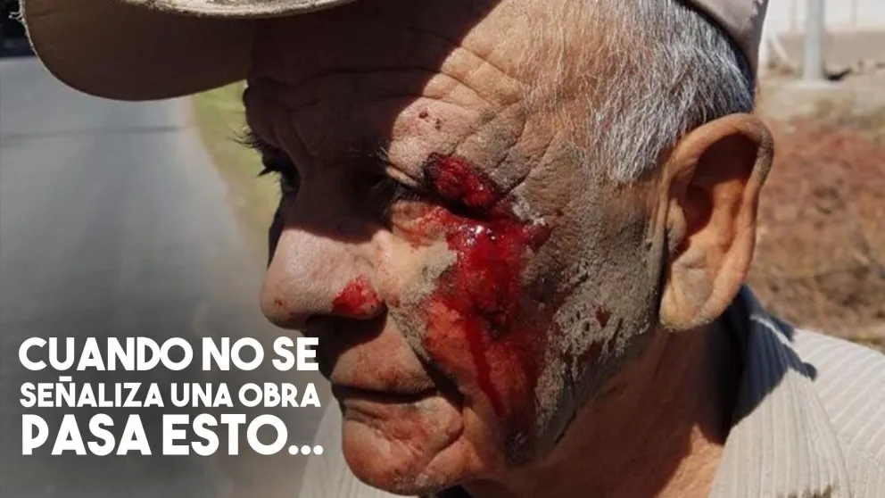 Un abuelo se cayó de la bicicleta y se lastimó la cara por una obra sin señalizar