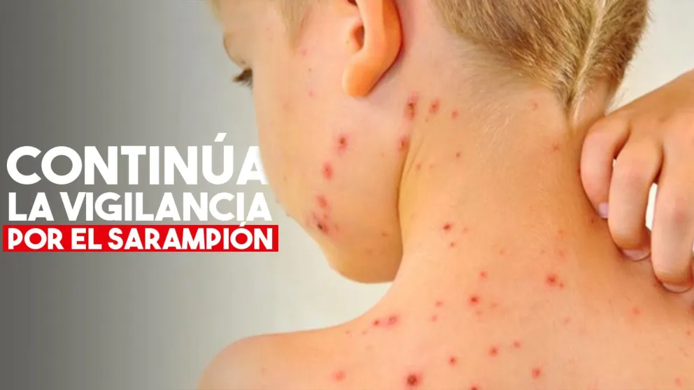 En San Juan también hay vigilancia por el Sarampión