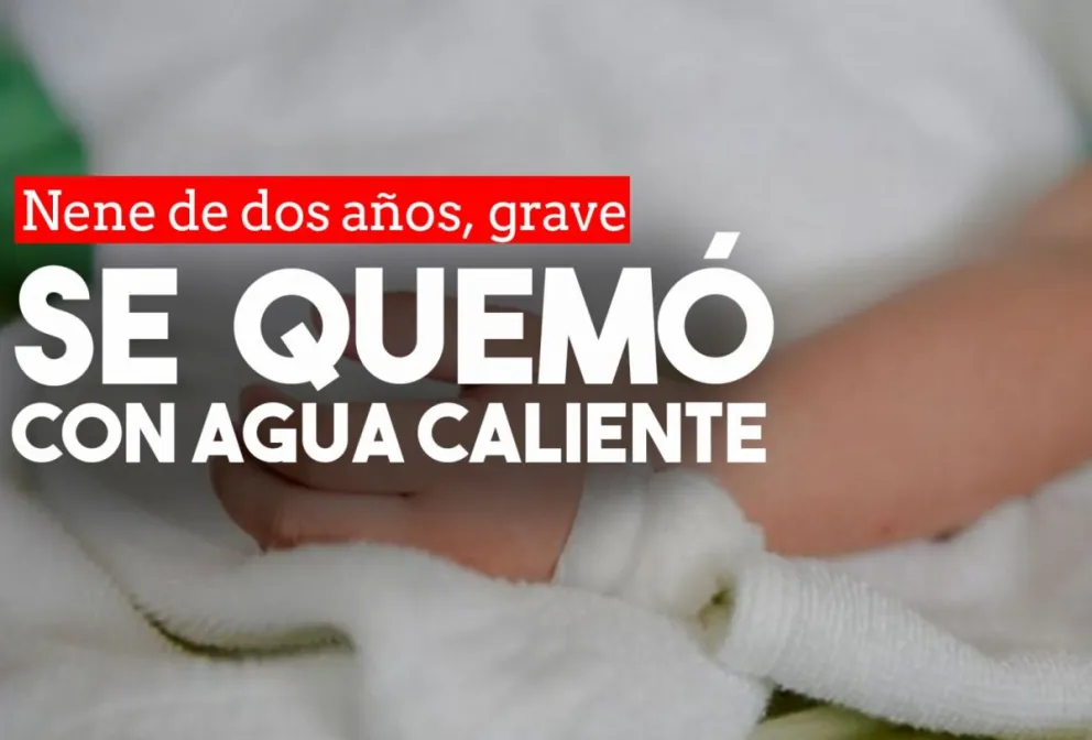 Un nene de dos años está grave luego de que se le cayera una olla con agua caliente