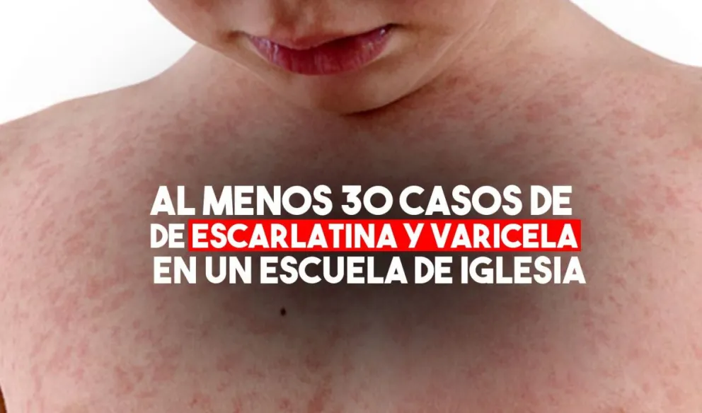 Preocupación por casos de escarlatina y varicela en una escuela