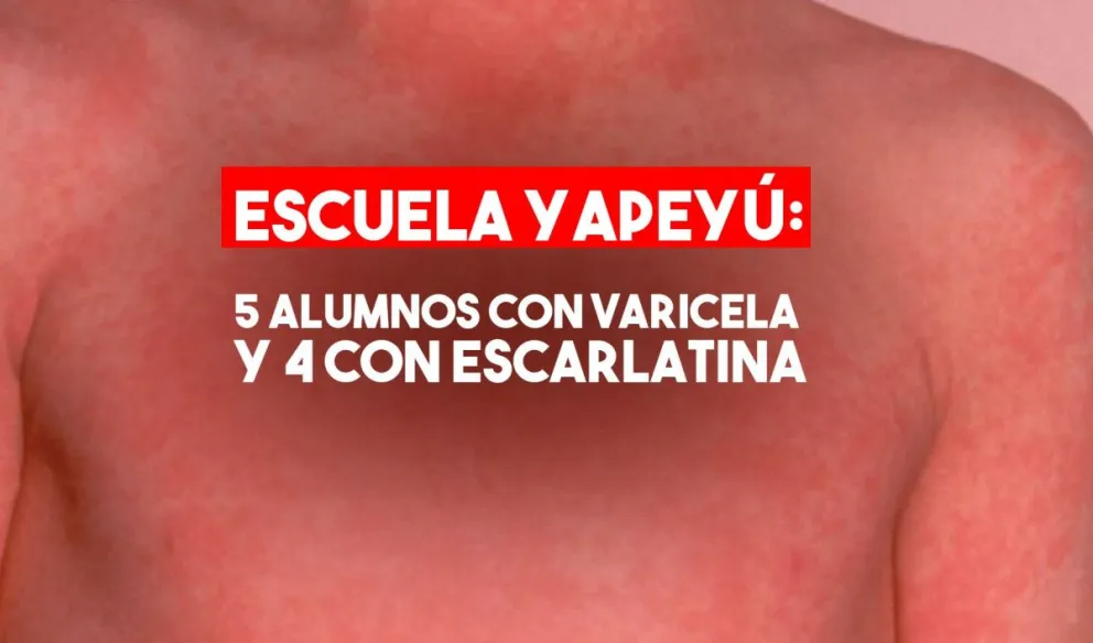 Confirmaron 5 casos de varicela y 4 de escarlatina en la escuela de Iglesia