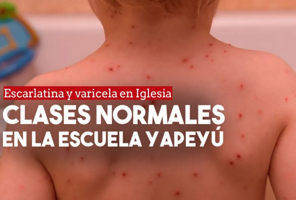 Las clases son normales en la escuela donde encontraron casos de varicela y escarlatina