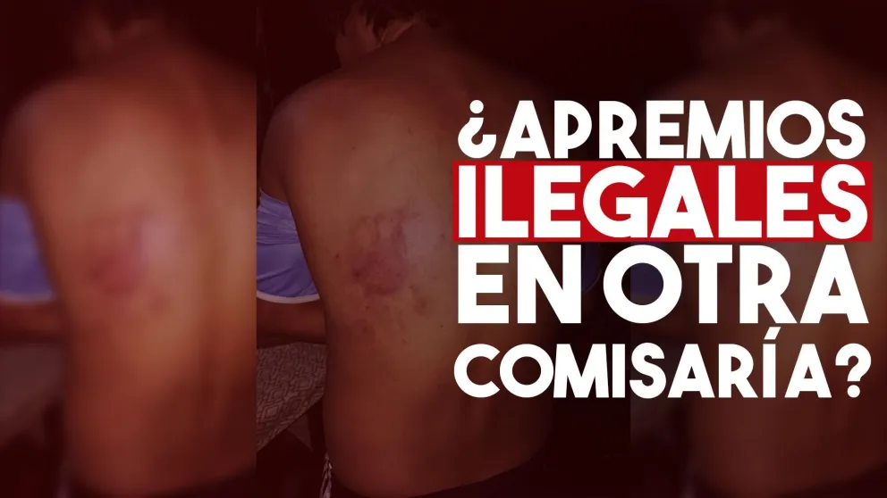 Denunciaron a una comisaría por una brutal golpiza y serán investigados