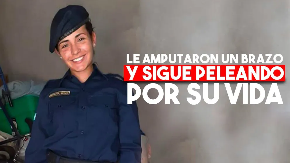Belen sufrió la amputación de su brazo izquierdo y sigue grave