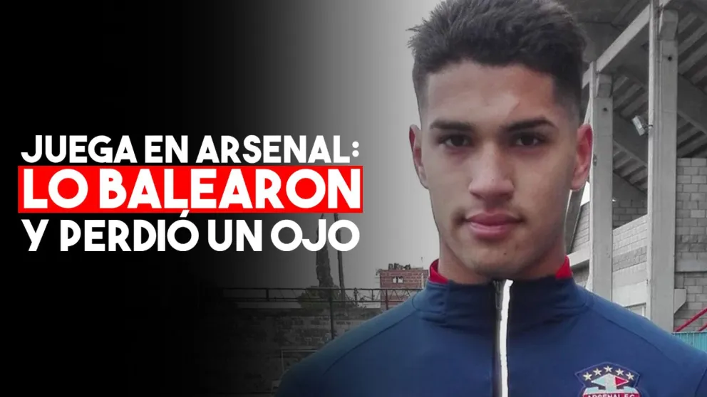 Balearon a un jugador de Arsenal: perdió un ojo y tiene comprometido el otro