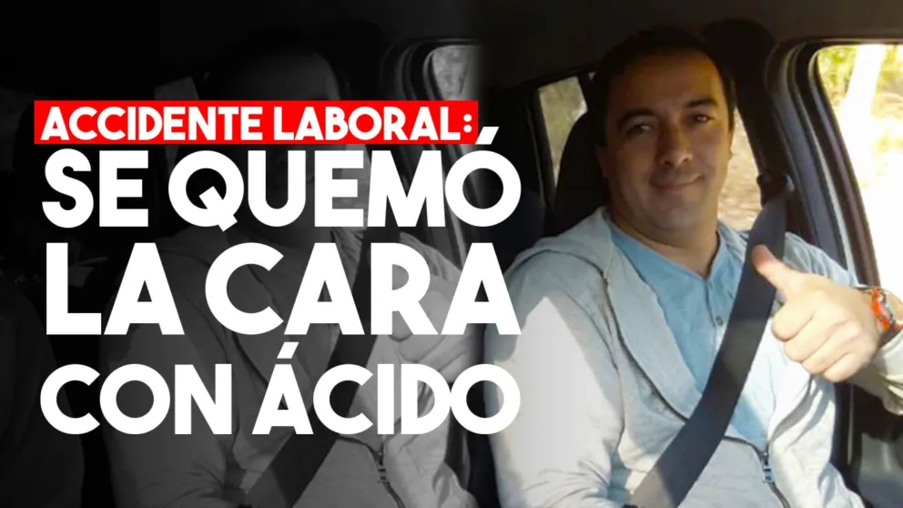 Abrió un tacho con ácido en su trabajo y se quemó