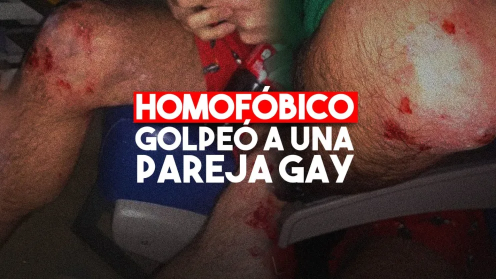 Ataque homofóbico: un hombre persiguió y golpeó con un látigo a una pareja gay