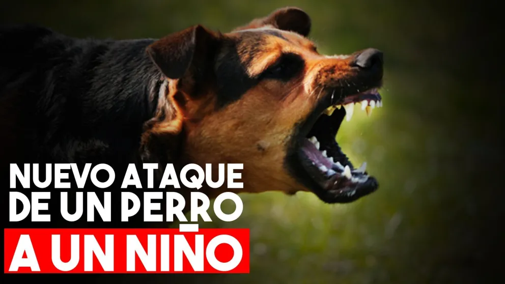 Un perro se le escapó al dueño, atacó a un nene y lo dejó con graves heridas