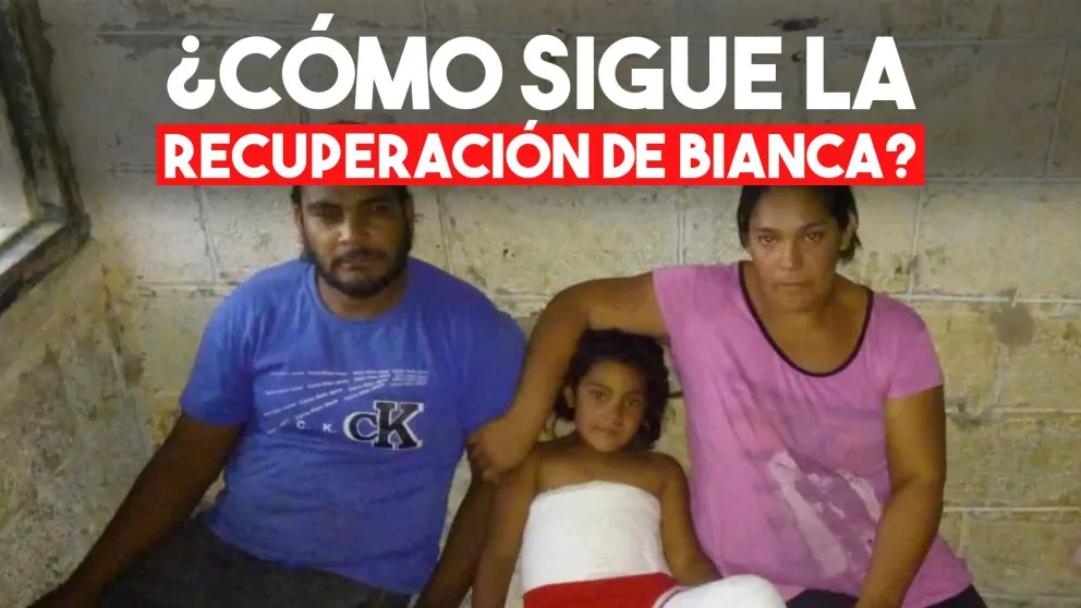 Se le cayó un portón encima y ahora deberá ser operada en una de sus piernas